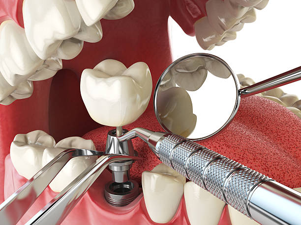 Best Pediatric Emergency Dentist in Rmichael, CA